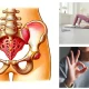Consigli salute pavimento pelvico